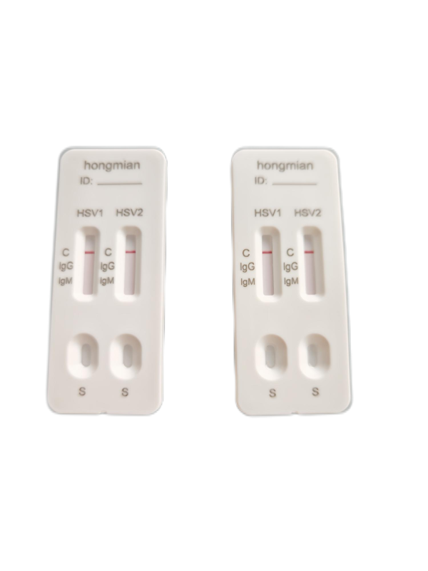 2-in-1 IgMIgG Detection Kit for Herpes Simplex Virus Type 1/2 Hongmian Manufacturer