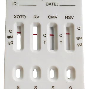 4-in-1 Toxoplasma Rubella Cytomegalovirus Herpes Simplex IgM IgG Detection Kit Wholesale